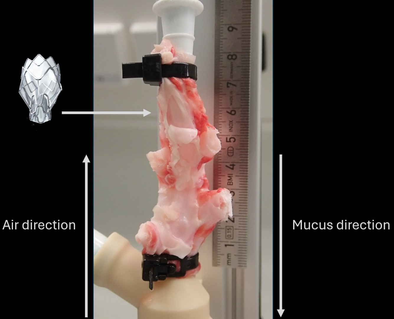 Developing the next generation of endobronchial valves: Identifying the optimal design for one-way air flow and decreased immune response