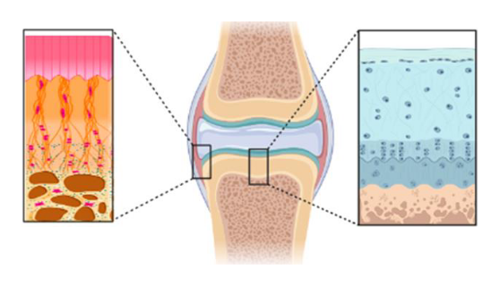 Additive manufacturing of a novel class of implants with heterogeneous structures, combining different biomaterials and printing methods